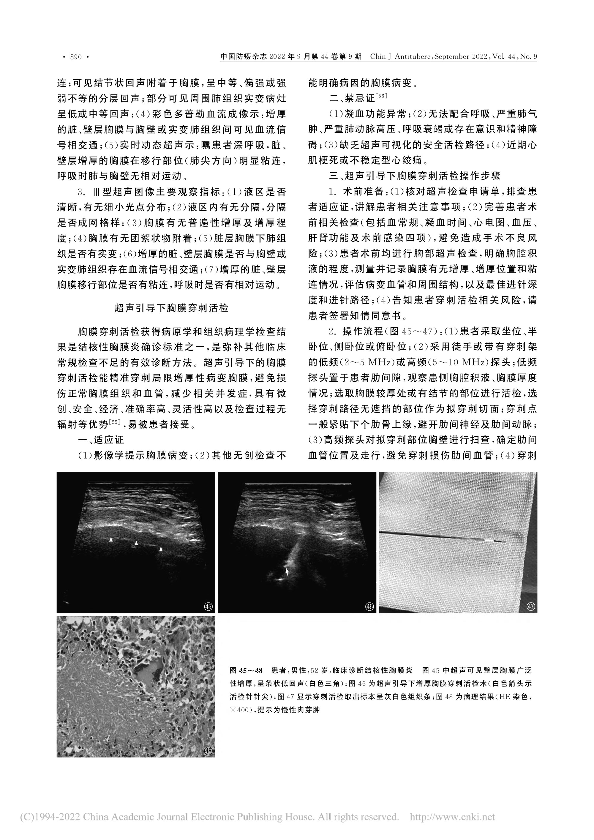 2022结核性胸膜炎超声诊断、分型及介入治疗专家共识(2022年版)-11.jpg